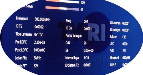 Apa Itu Bedah Bunion? yang bagus