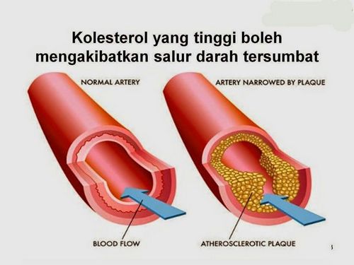 Apa Kolesterol dalam Darah? tentang apakah