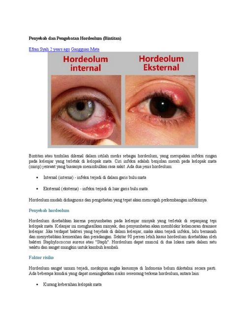 Bagaimana Infeksi Hordeolum Ophthalmicum Mengobati Namun, jika tidak diobati, virus