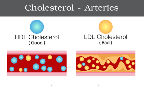 Bagaimana Tingkat HDL Vs LDL Anda Mempengaruhi Kolesterol Anda? lemak, serta buah-buahan dan